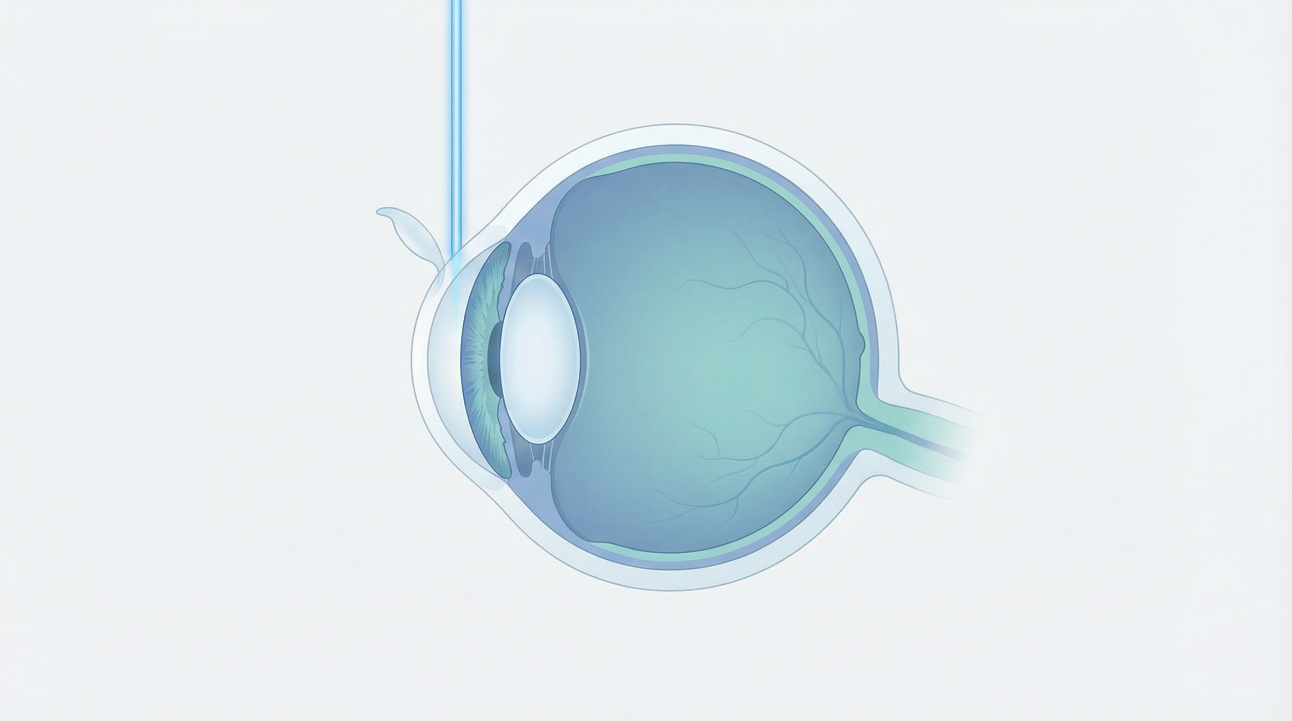 Augenlaser-Operation: Was die Studien wirklich zeigen